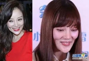 刘雨欣下巴怎么回事 可能是下巴微调过