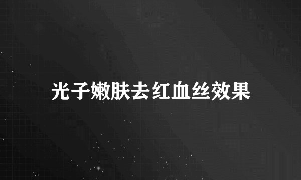 光子嫩肤去红血丝效果