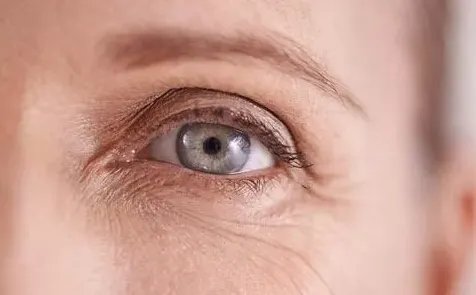 怎么去脸上的鱼尾纹