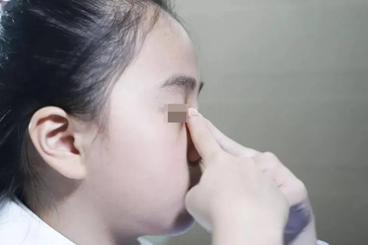 眼睛保健的方法及图片