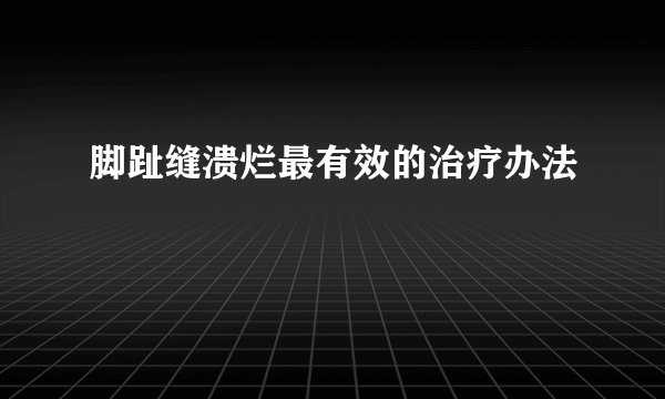 脚趾缝溃烂最有效的治疗办法