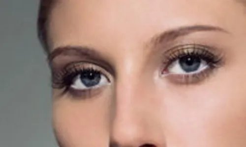 双眼皮手术全切