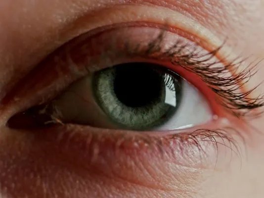 眼球周围发黄是什么原因