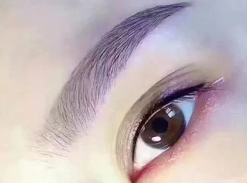 北京双眼皮手术多少钱