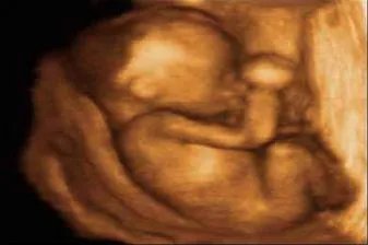 胎儿的四维彩超图片