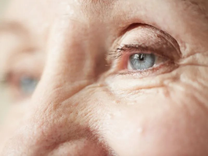 眼部注射除皱方法有哪些