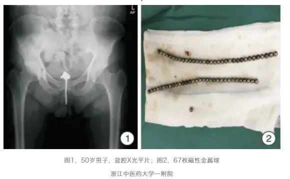 别往菊花和丁丁里塞奇怪的东西了,取出来的时候很疼的!