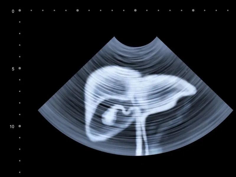 造影什么时候做