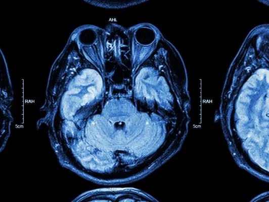 打封闭针的作用有哪些