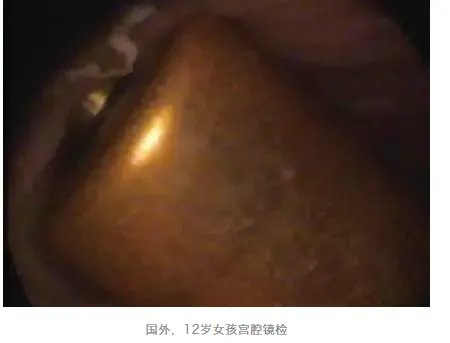 别往菊花和丁丁里塞奇怪的东西了,取出来的时候很疼的!