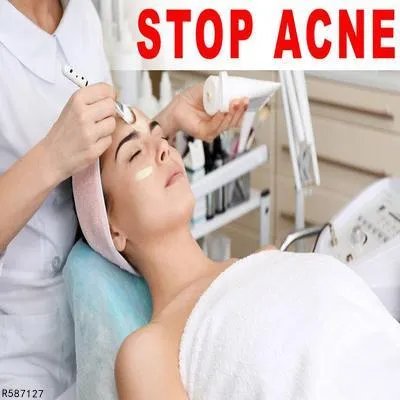 女生如何去黑头