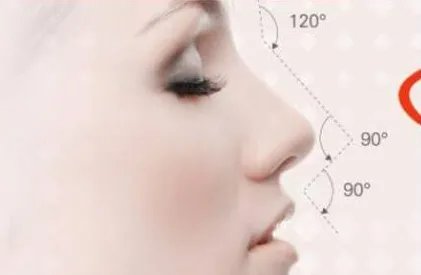 注射隆鼻手术医院哪家好