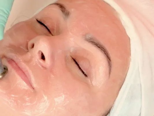 果酸换肤会反弹吗