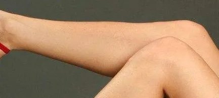 botox瘦小腿如何