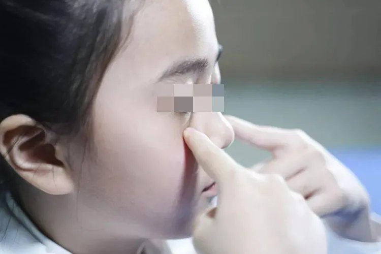 眼睛保健的方法及图片