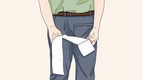 盆底痉挛综合症都有哪些表现