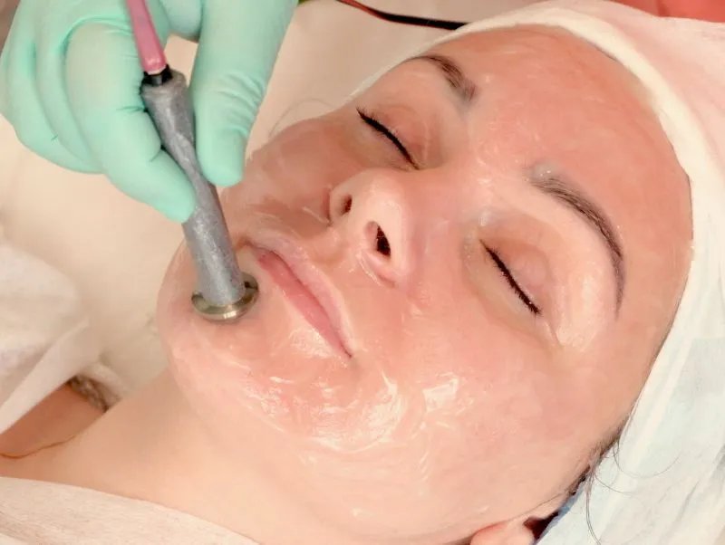 黑脸娃娃激光美容