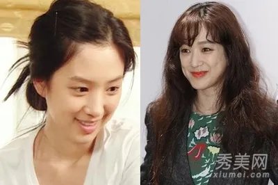 郑丽媛整容前后对比图 郑丽媛南太铉有孩子了吗