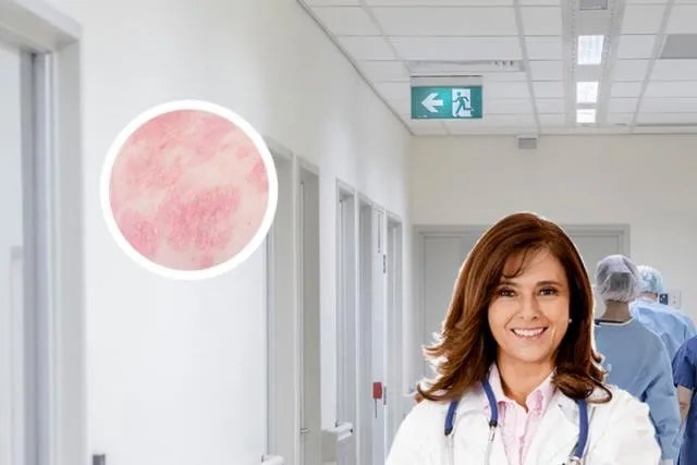 治疗牛皮癣的克星