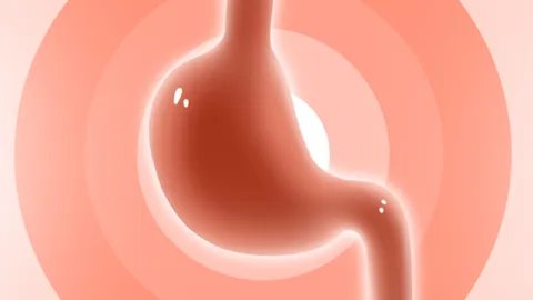 贲门疾病应该怎么治疗