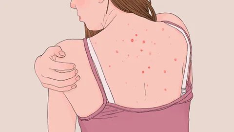 去鸡皮肤能用什么沐浴露