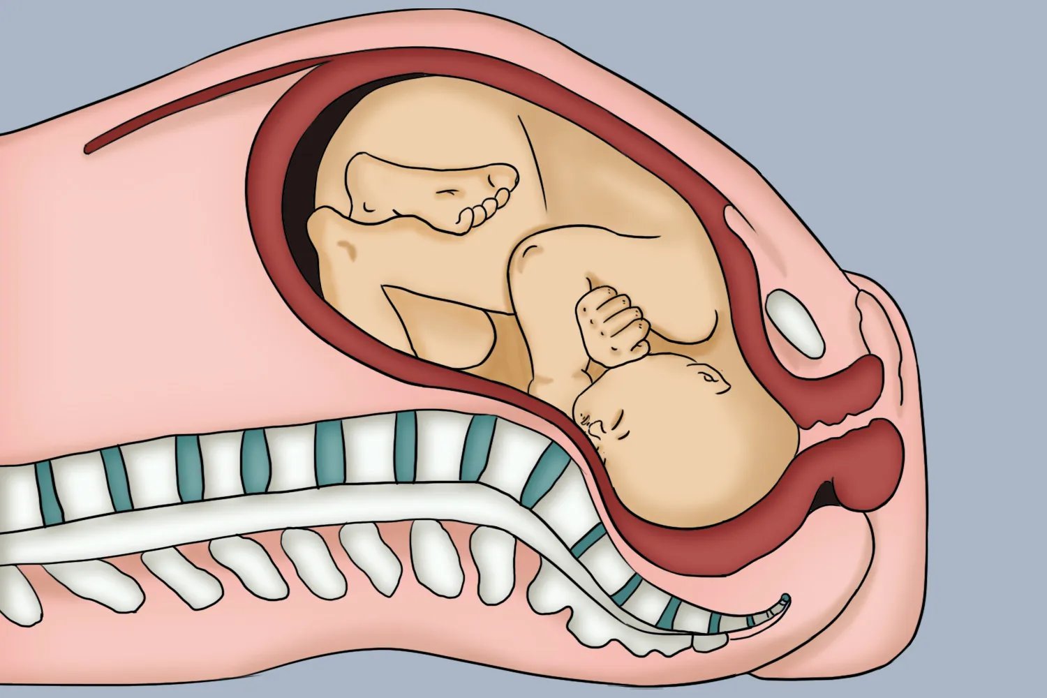 全入盆和半入盆图片