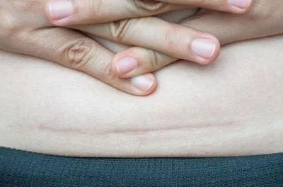 姚贝娜癌症早期手术成功 早期癌症治疗的注意事项