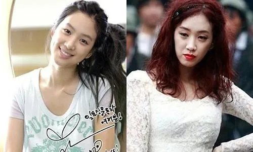 郑丽媛整容前后对比图 郑丽媛南太铉有孩子了吗