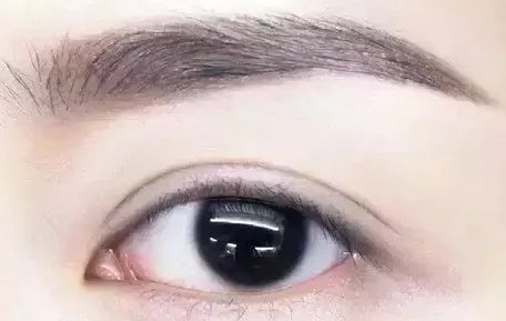 北京割双眼皮费用一般是多少