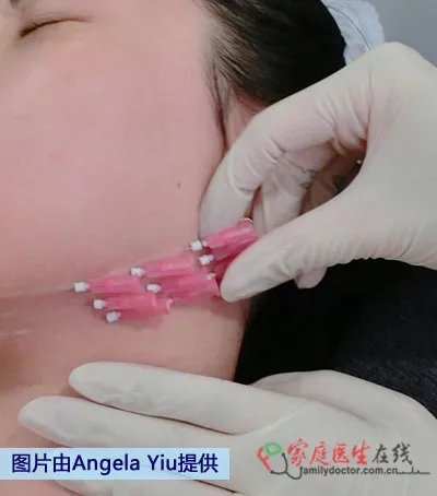 带你到香港寻找微整形新概念