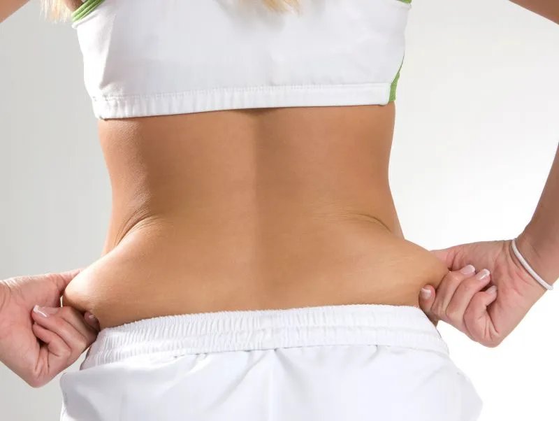 如何减后腰