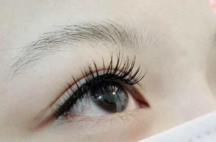 韩式无痕双眼皮需要多少钱