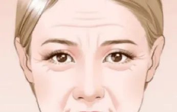 玻尿酸注射去皱价格大概多少