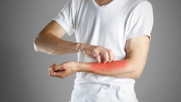 季节性过敏怎么办