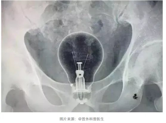 别往菊花和丁丁里塞奇怪的东西了，取出来的时候很疼的！