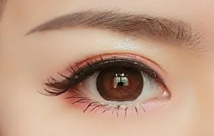 北京开眼角需要多少钱