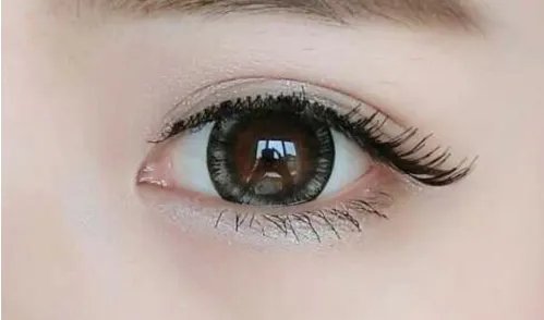 埋线双眼皮修复有什么坏处