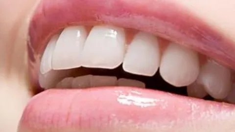 苏州牙齿矫正的费用