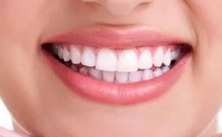 镶牙种植牙费用