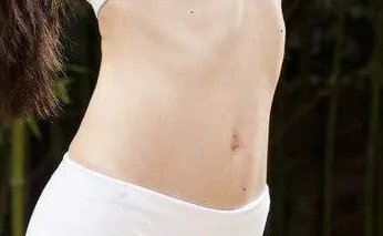 腰腹部吸脂多久能好