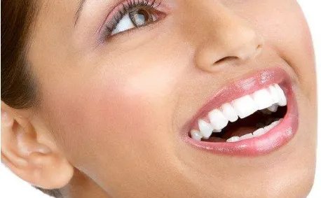 全瓷贴面牙价格是多少