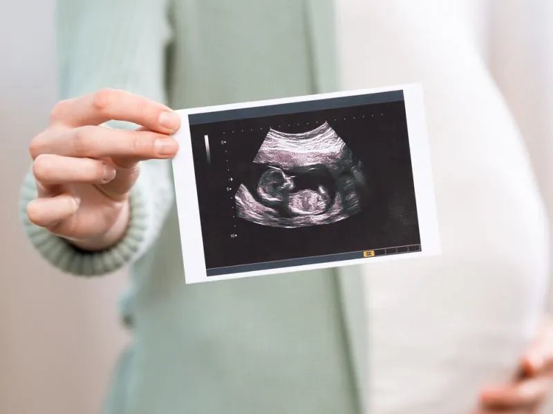 孕期护理怎么做