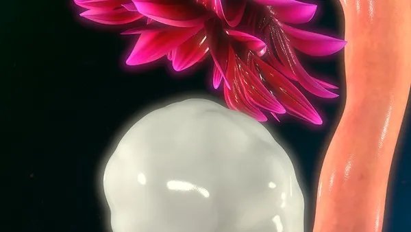 新冠感染人群会出现中风症状吗?新冠病毒会诱发偏瘫吗?