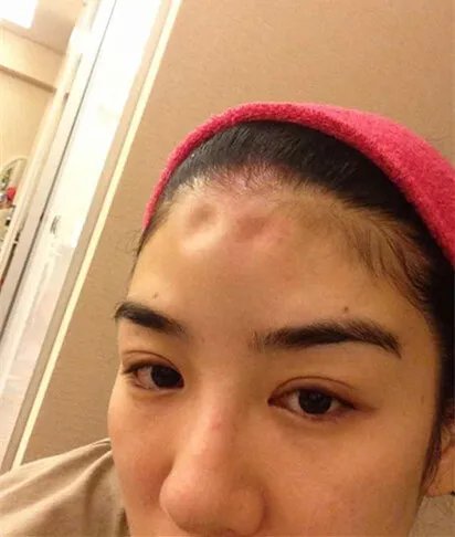 黄奕晒家暴照片 发声明否认出轨