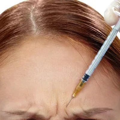 手术拉皮除皱的好处