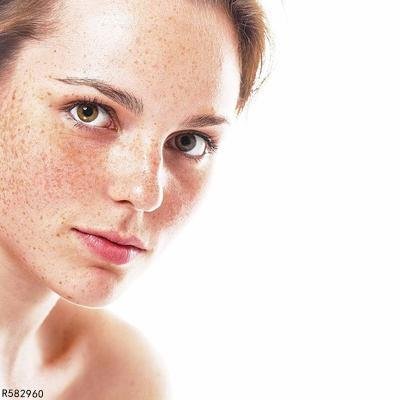 柠檬祛斑法有效吗