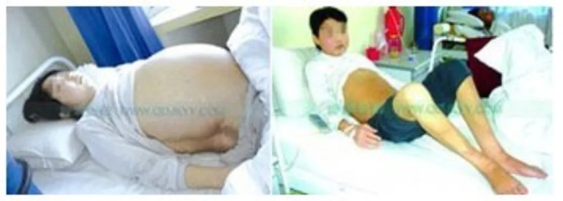 青岛静康中医肾病医院咨询电话是多少?