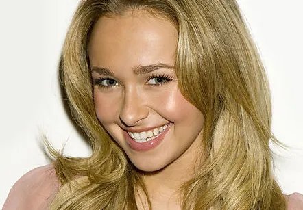 欧式双眼皮欧式双眼皮怎么样