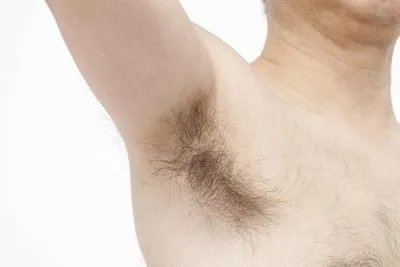腋毛上有白色的东西怎么去除