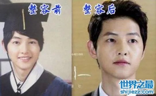 宋仲基整容前的照片对比，和亲妹妹容貌相差巨大 